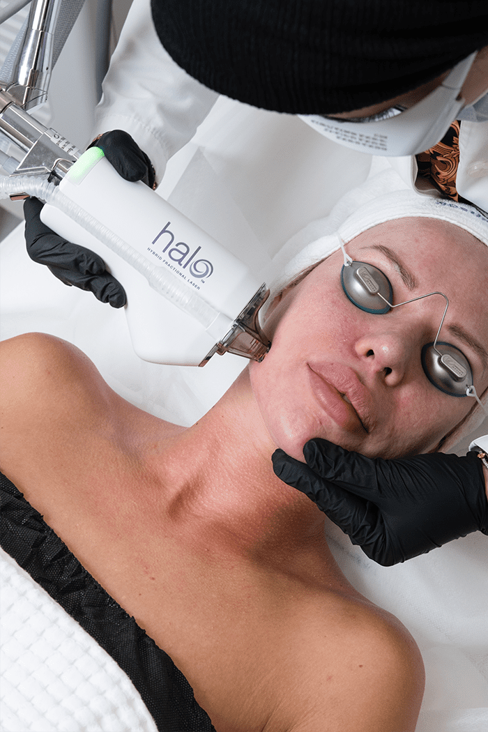HALO Facial Treatment in Dubai