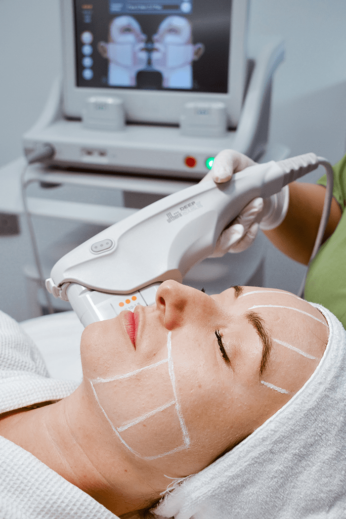 Ultherapy Facial Treatment in Dubai